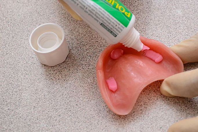 Чем можно приклеить зуб. Фиксирующий клей для зубных протезов. Гель для фиксации протезов.